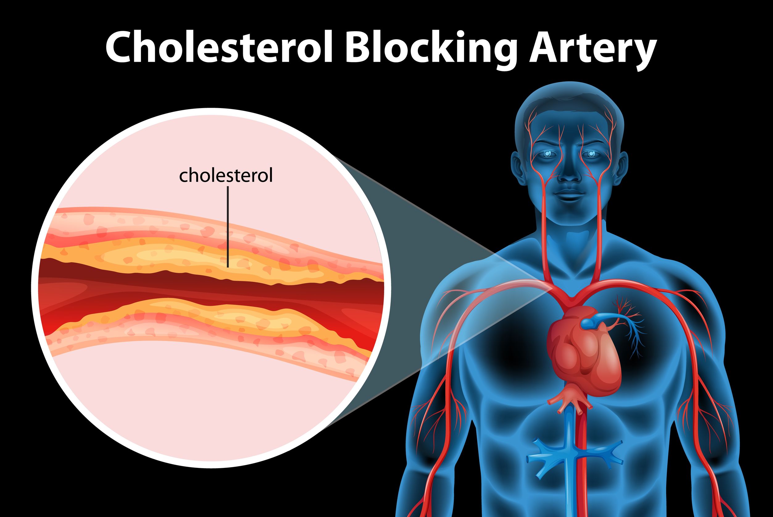 Cholesterol image 